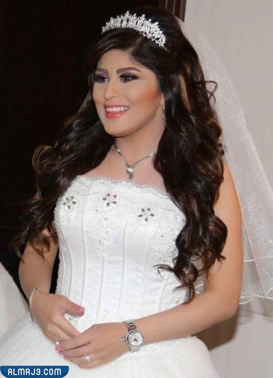 زارا البلوشي قبل وبعد التجميل