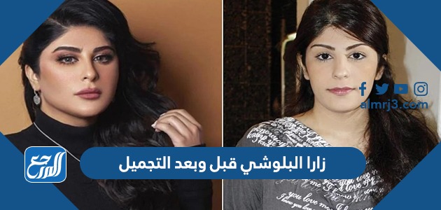 زارا البلوشي قبل وبعد التجميل