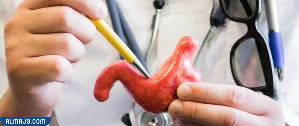 شروط عملية تكميم المعدة