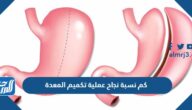 كم نسبة نجاح عملية تكميم المعدة وهل تشكل خطر