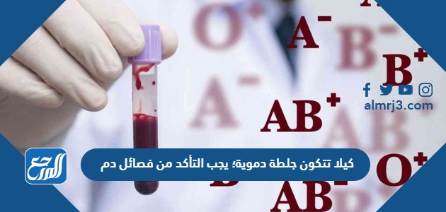 لكيلا تتكون جلطة دموية؛ يجب التأكد من فصائل دم كل من المريض والمتبرع قبل عملية نقل الدم .