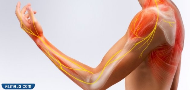 ما هي متلازمة الشخص المتيبس