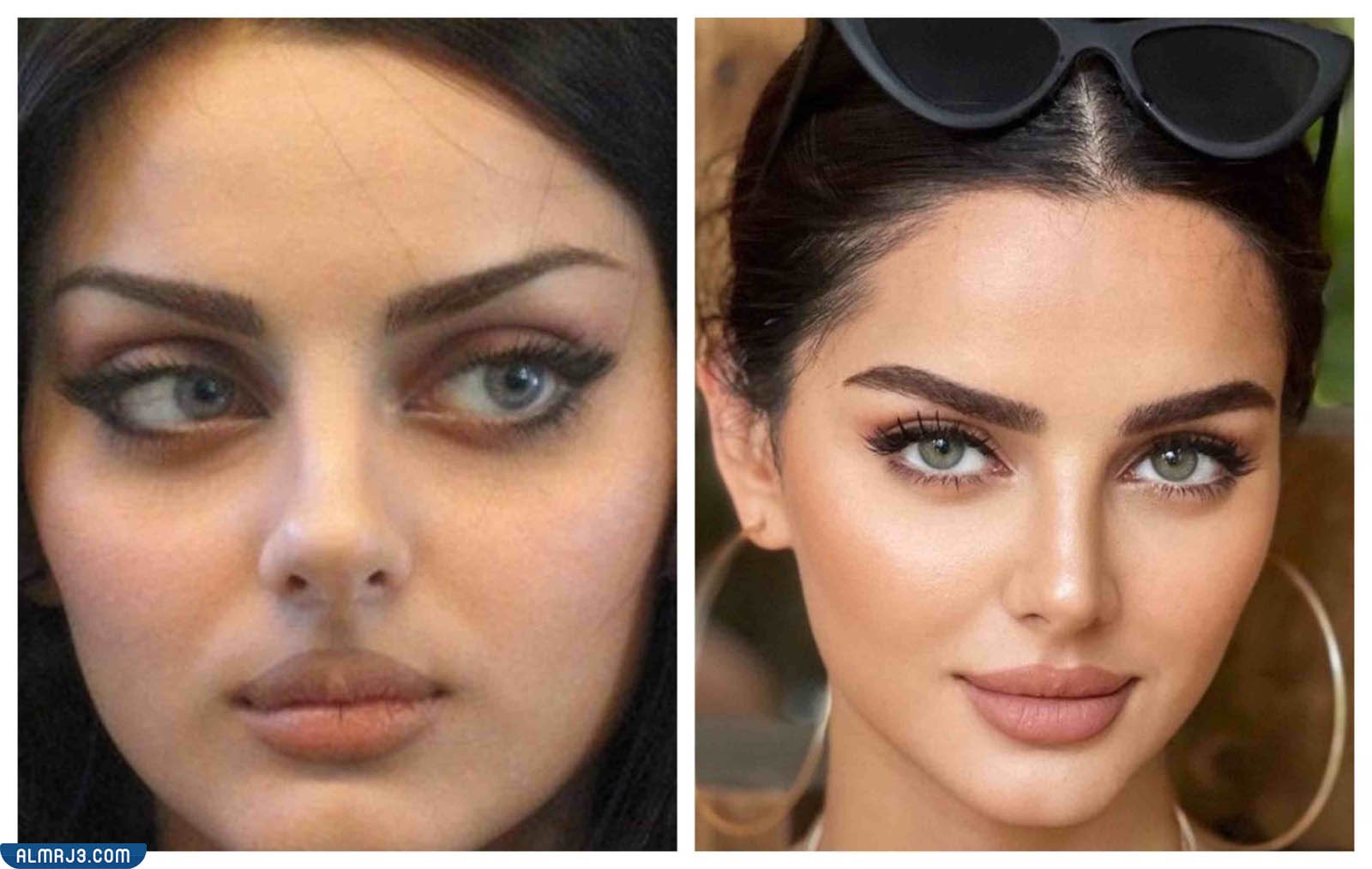 مهلقا جابري قبل وبعد