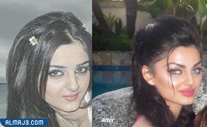 مهلقا جابري قبل وبعد