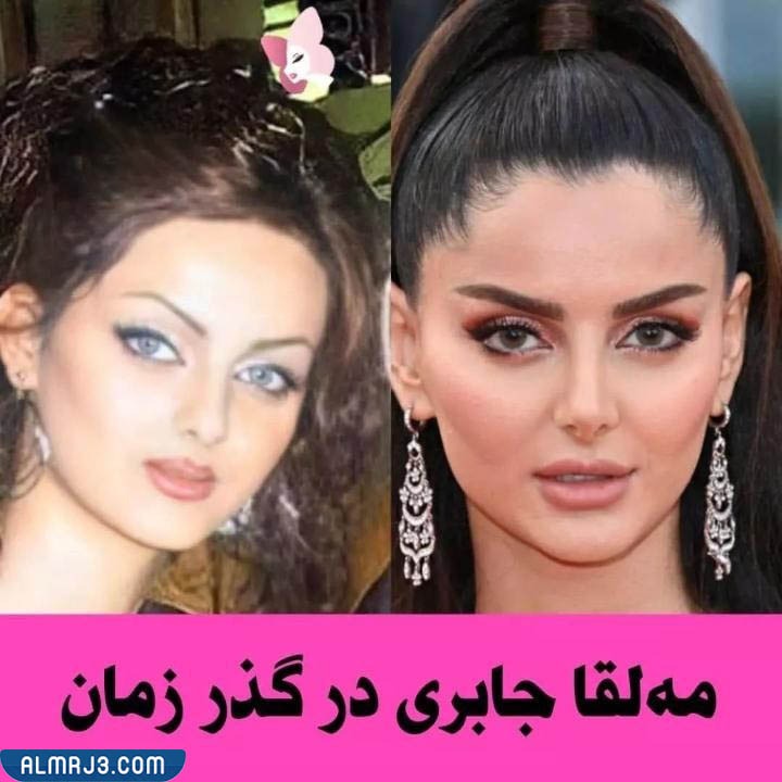 مهلقا جابري قبل وبعد