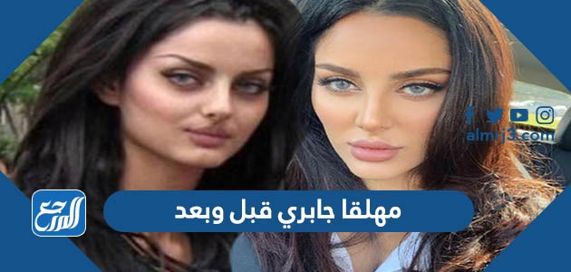 مهلقا جابري قبل وبعد