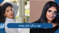 نور ستارز قبل وبعد
