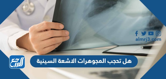 هل تحجب المجوهرات الاشعة السينية