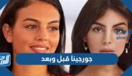صور جورجينا قبل وبعد