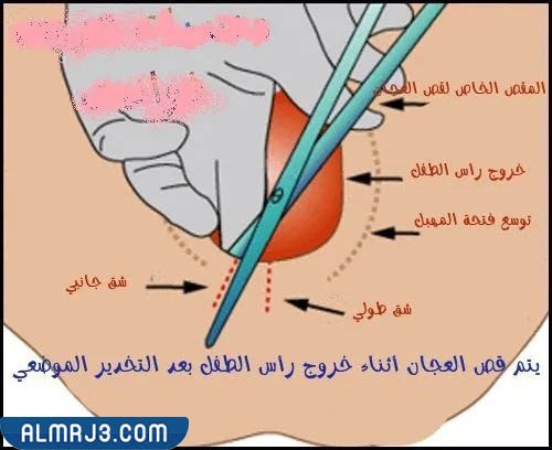 قص العجان بالصور 