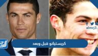 كريستيانو قبل وبعد التجميل