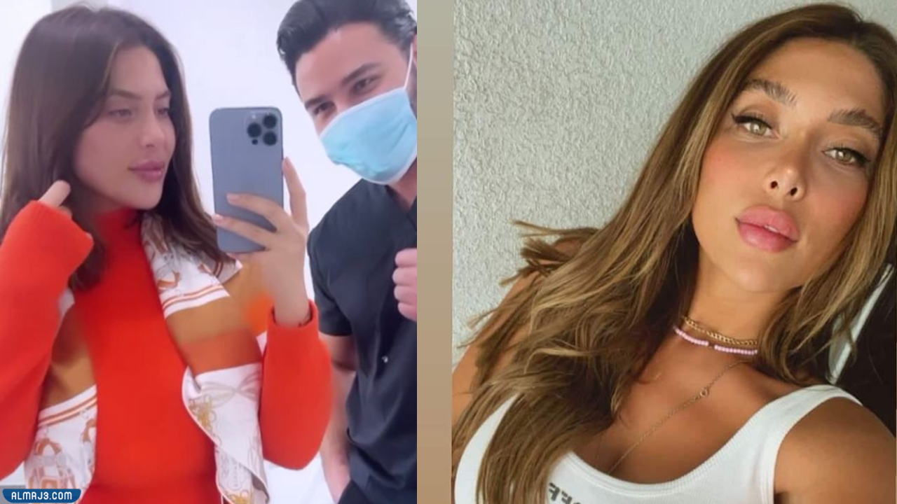 لين برنجكجي قبل التجميل