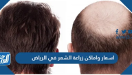 اسعار واماكن زراعة الشعر في الرياض 2025